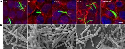 Destination and Specific Impact of Different Bile Acids in the Intestinal Pathogen Clostridioides difficile